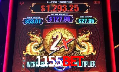 Live Casino 1155bet